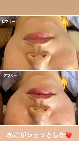 FLEURフェイシャ ル🫧ハーブ🌿小顔のエステ・リラクイメージ