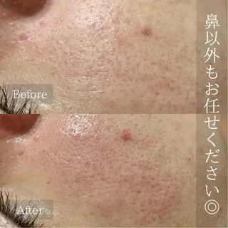 emiiny所属・emiiny 🌿フェイシャルのエステ・リラクイメージ