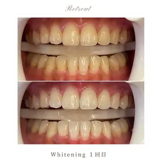 Retreatリトリート所属・歯科医院提携 Retreatのエステ・リラクイメージ