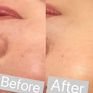 アイラッシュ&エステサロンLinda西宮所属・小顔&毛穴・肌質改善 LINDA西宮 AIのエステ・リラクイメージ