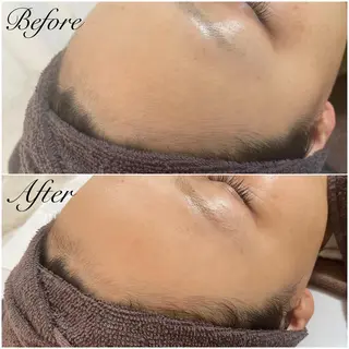 都度払い制脱毛サロンBe Charm所属・Be Charm 山﨑のエステ・リラクイメージ