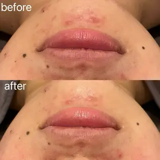 小顔＆まつ毛サロン AKANE❤️のエステ・リラクイメージ