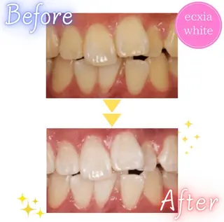 セルフホワイトニング エクシア札幌琴似店のその他イメージ