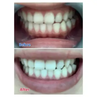 M渋谷店所属・M渋谷 ホワイトニングのエステ・リラクイメージ