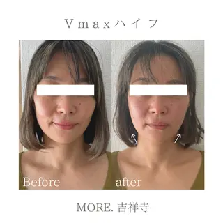 MORE. NEMAのエステ・リラクイメージ