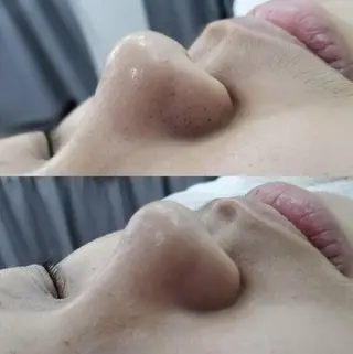 癒林 イカンのマツエク・マツパデザイン