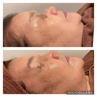 セミロング カラー パーマ ヘアアレンジ メンズ キッズ ネイル マツエク・マツパ アイブロウ ニキビ特化型エステ 🍓最短で肌質改善のエステ・リラクイメージ