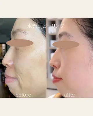 美腸サロン🌺 腸もみ/小顔/リンパのエステ・リラクイメージ