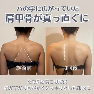 小顔矯正/骨格矯正 AKANEのエステ・リラクイメージ