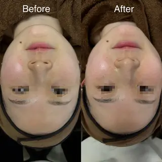 看護師が施術する小顔 サロン/KIKIのエステ・リラクイメージ