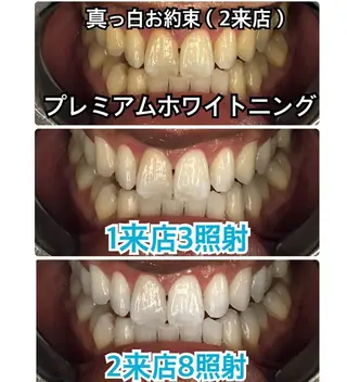 Platinum Beauty 四条烏丸店所属・吉田亮利 ホワイトニング専門店のその他イメージ