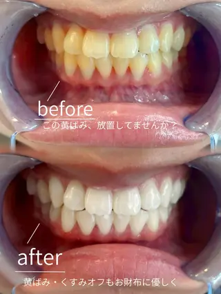 B onitoのエステ・リラクイメージ