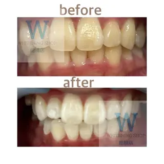 ホワイトニング ショップ船橋２号店のエステ・リラクイメージ