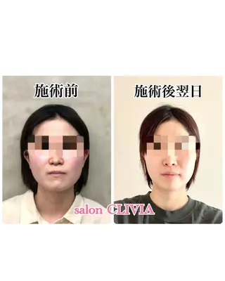 salon CLIVIA, クリヴィア所属・無痛小顔矯正 クリヴィアのエステ・リラクイメージ