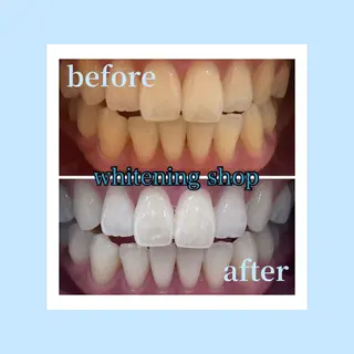 ホワイトニングショップ光明池店所属・ホワイトニング ショップ光明池店のエステ・リラクイメージ