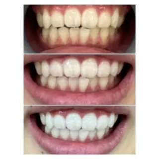 MBEAUTYSALON 千葉店・京成大久保所属・Melty 輝のその他イメージ