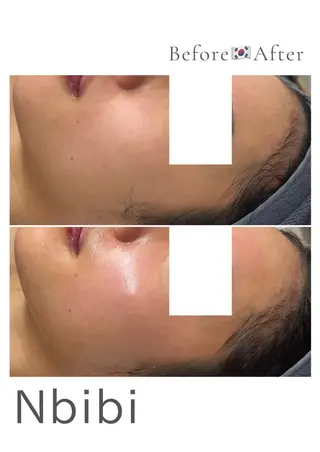 韓国🇰🇷価格 サロン_Nbibiのエステ・リラクイメージ