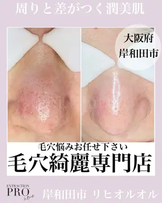 毛穴汚れ改善専門店/ 岸和田/リヒオルオルのエステ・リラクイメージ