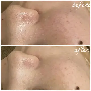 メンズ メナード岐阜市茜部 杉浦のエステ・リラクイメージ