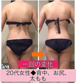 ショート カラー パーマ ヘアアレンジ メンズ キッズ ネイル マツエク・マツパ ‍痩身＆ボディ 結果出し🌟丹野のエステ・リラクイメージ