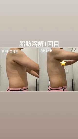 毛穴洗浄・痩身・脱毛 /アルカンジュのエステ・リラクイメージ