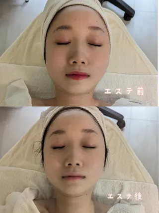 池田 夏鈴のエステ・リラクイメージ