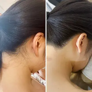 うなじ脱毛/美肌脱毛 LABELのエステ・リラクイメージ