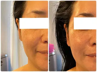 Anjir（アンジール）所属・完全個室サロン Anjirのエステ・リラクイメージ