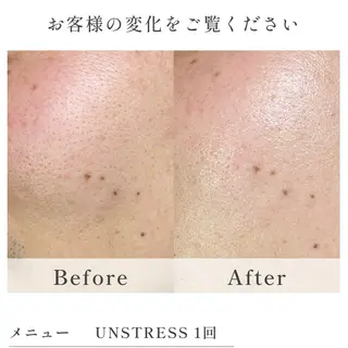 SALON Belluce【ベルーチェ】所属・中村 萌々のエステ・リラクイメージ