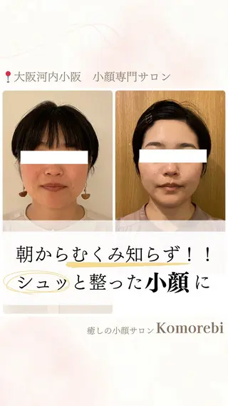 営業電話❌小顔サロン Komorebiのエステ・リラクイメージ