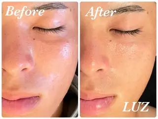 メンズ メンズフェイシャル アイブロウ・ルースのエステ・リラクイメージ