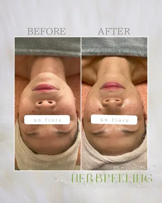 un Fiore🌷所属・小顔ハーブピーリング un.Fiore🌷のエステ・リラクイメージ