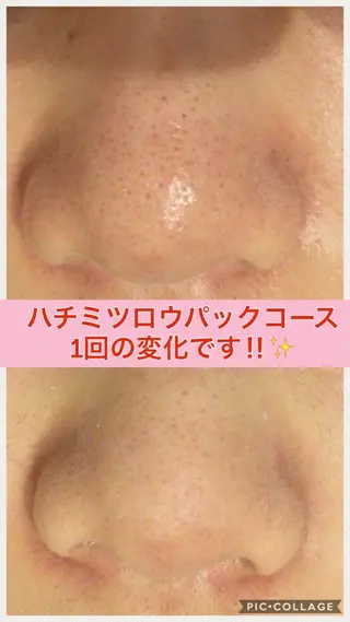 ショート カラー パーマ ヘアアレンジ メンズ キッズ ネイル マツエク・マツパ ニキビ・肌質改善専門 ♡人生が変わるサロンのエステ・リラクイメージ