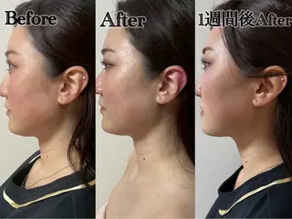 六本木/似合わせ眉毛 andＳ🍀Yuriのエステ・リラクイメージ