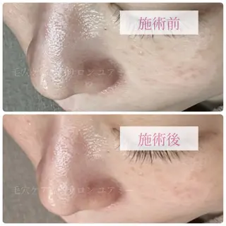 毛穴肌質ケアサロン Yourmeユアミーのエステ・リラクイメージ