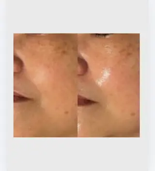 肌管理フェイシャル|Utouto所属・肌管理フェイシャル Utoutoのエステ・リラクイメージ