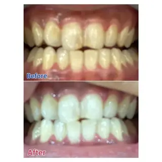 M渋谷店所属・M渋谷 ホワイトニングのエステ・リラクイメージ