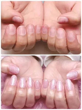 ネイル 深爪を断らない スカルプ高評価店のネイルデザイン