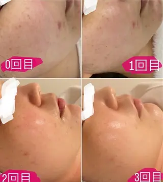 Re Amply Minamiのエステ・リラクイメージ