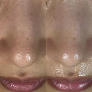 🩵atelier- 01 優奈🩵のネイルデザイン