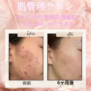 愛維美水光美肌専門店所属・愛維美水光美肌専門店 メンズレディースokのエステ・リラクイメージ