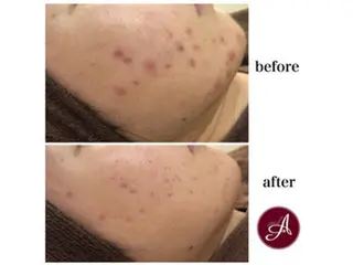 ミディアム カラー パーマ ヘアアレンジ メンズ キッズ ネイル マツエク・マツパ ニキビ・肌質改善専門 ♡人生が変わるサロンのエステ・リラクイメージ