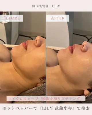 LILY所属・KAORU .のエステ・リラクイメージ