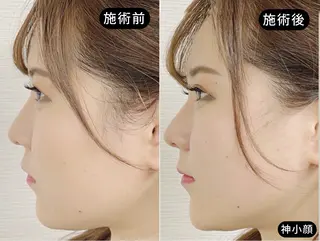 小顔美容鍼専門サロン 渋谷YZのエステ・リラクイメージ