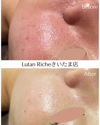 Lutan Richeさいたま店所属・ルタンリッシュ さいたま店のエステ・リラクイメージ