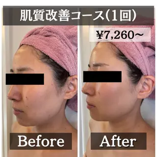 【肌質改善・リフトアップ専門店】セラピックエステ美極所属・羽賀 茉衣子のエステ・リラクイメージ