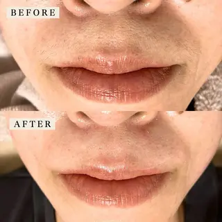 【産毛・眉毛ケア＆肌質改善サロン】＊BiBi＊beautysalon所属・眉･産毛専門BiBi 糸脱毛スレッティングのエステ・リラクイメージ