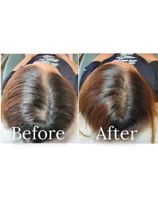 歯科提携セルフダック 宇都宮駒生店のエステ・リラクイメージ