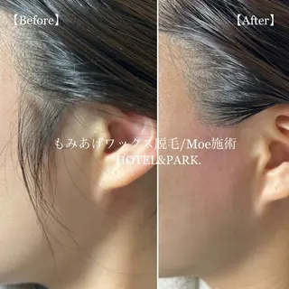 HOTEL&PARK .Moeワックス脱毛のエステ・リラクイメージ