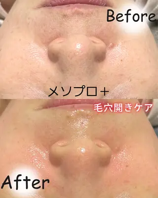 リンパ・小顔サロン PuReTeのエステ・リラクイメージ